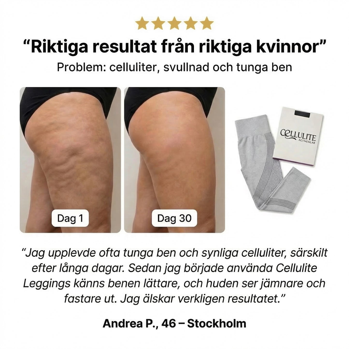 Cellulite Leggings - Trivs Med Kroppen, Oavsett Ojämnheter
