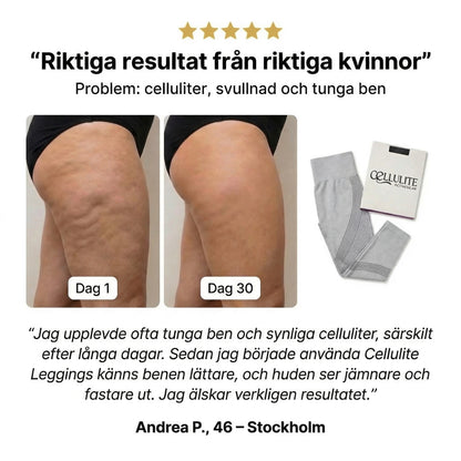 Cellulite Leggings - Trivs Med Kroppen, Oavsett Ojämnheter