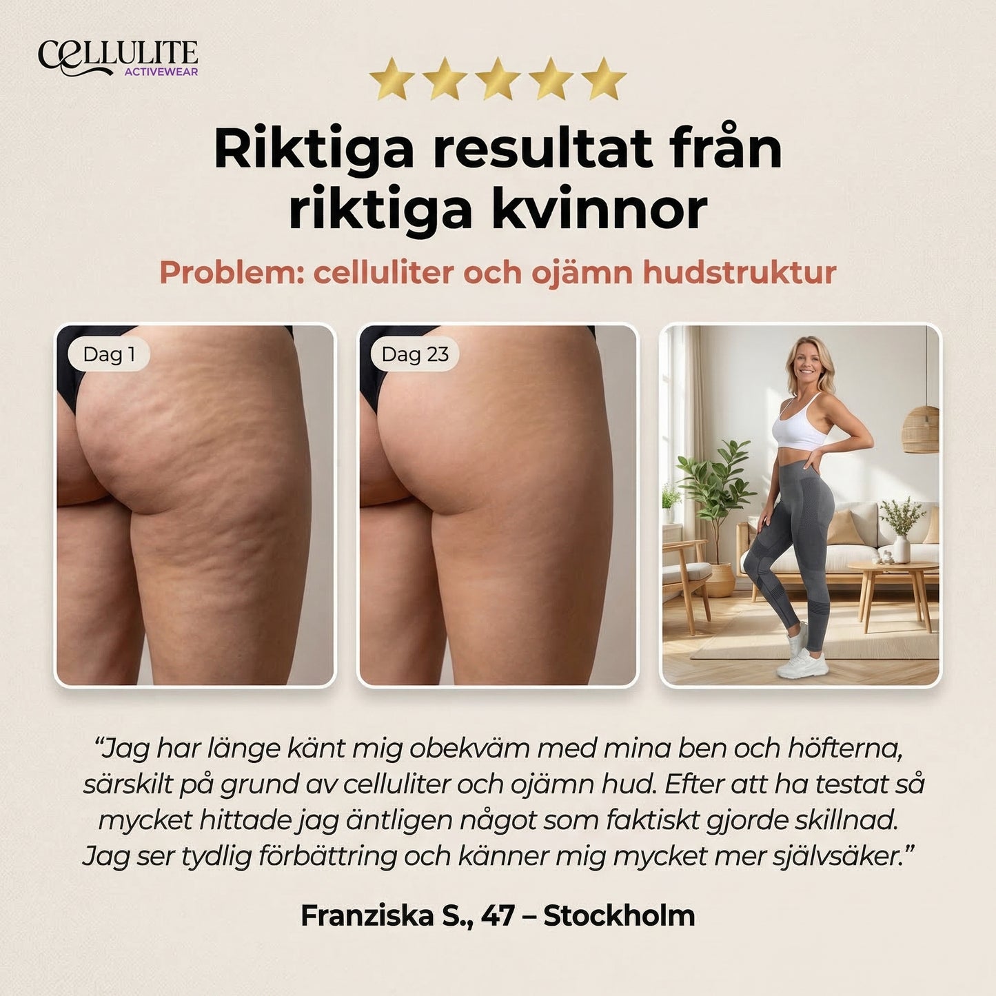 Cellulite Leggings - Trivs Med Kroppen, Oavsett Ojämnheter